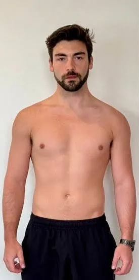 Before — AFTER 8 MONTH